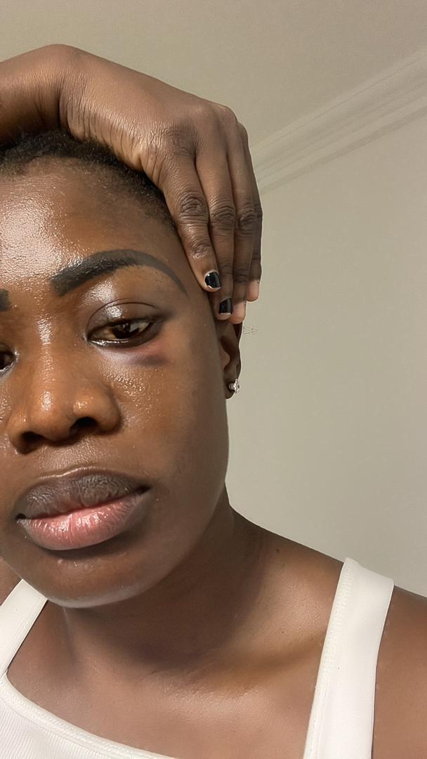 Ghanaian actress Nana Akua Addo hospitalised after allegedly being b@ttered by her husband (video)