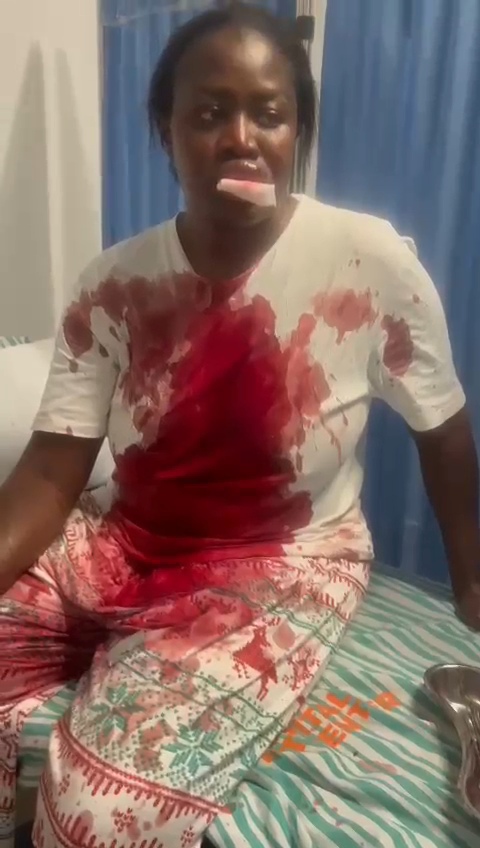 Ghanaian actress Nana Akua Addo hospitalised after allegedly being b@ttered by her husband (video)