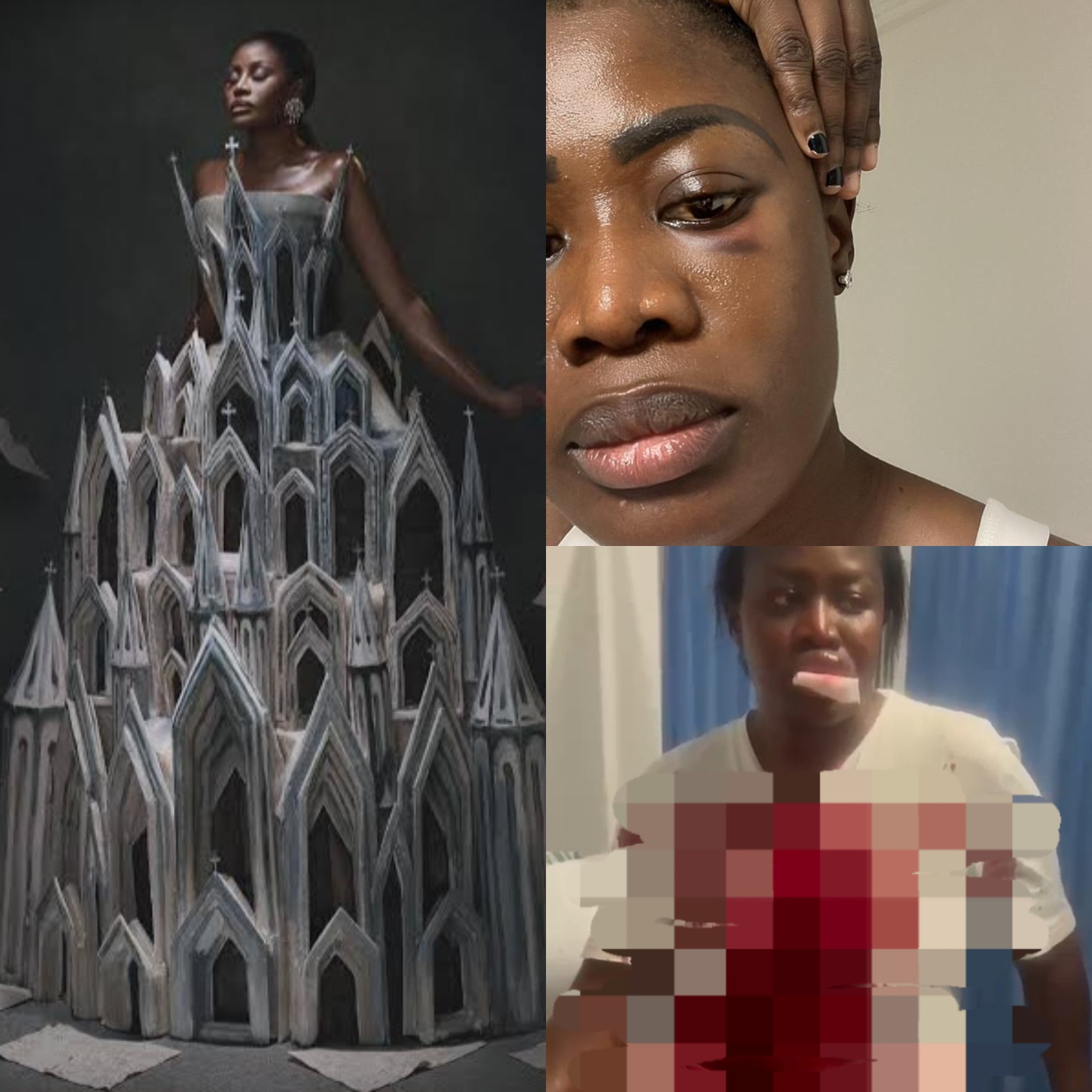 Ghanaian actress Nana Akua Addo hospitalised after allegedly being b@ttered by her husband (video)