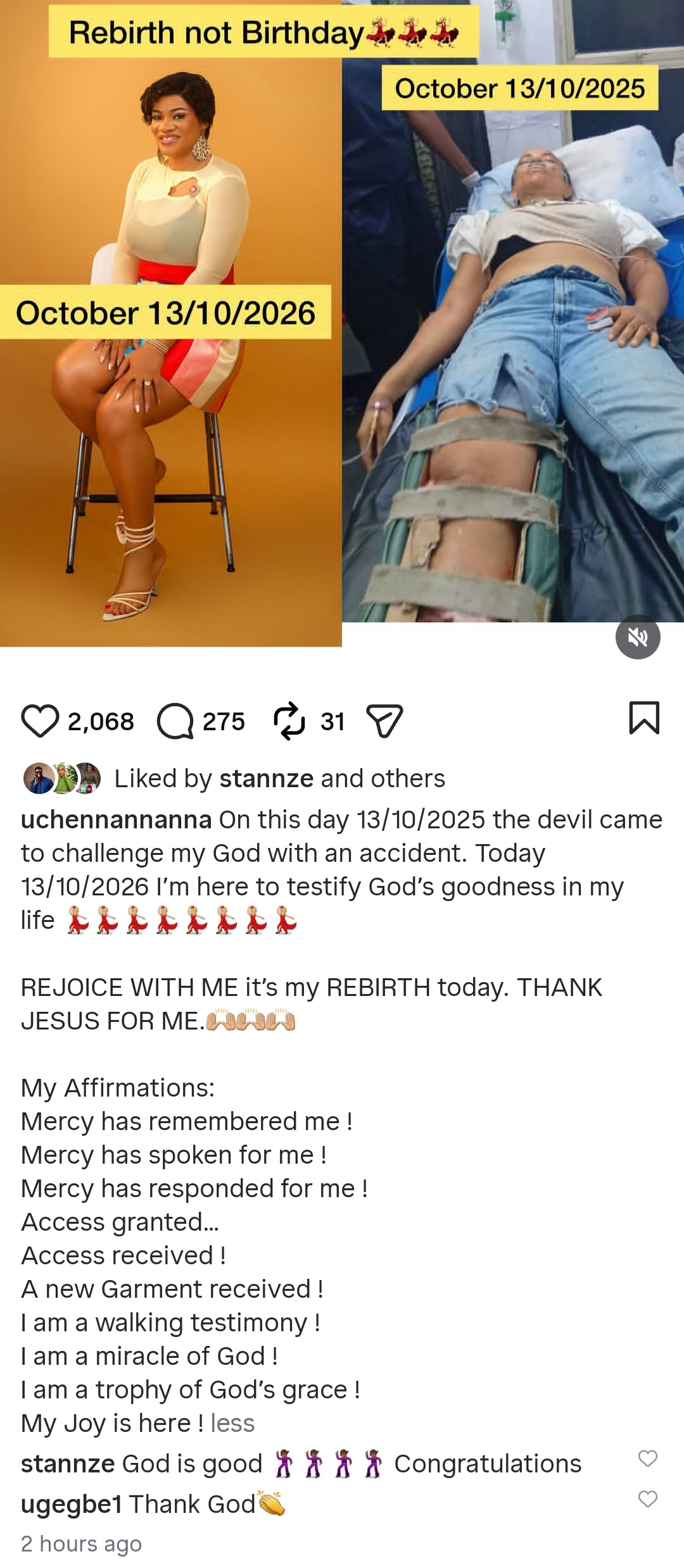 Actress Uche Nnanna shows scars as she reveals she survived terrible accident
