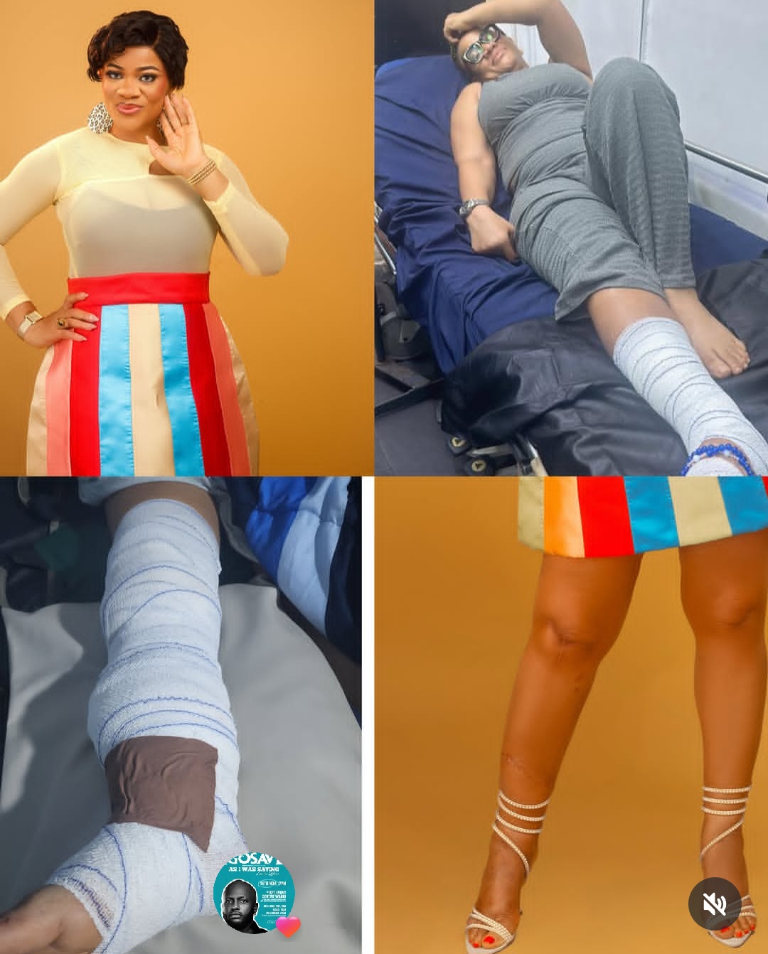 Actress Uche Nnanna shows scars as she reveals she survived terrible accident