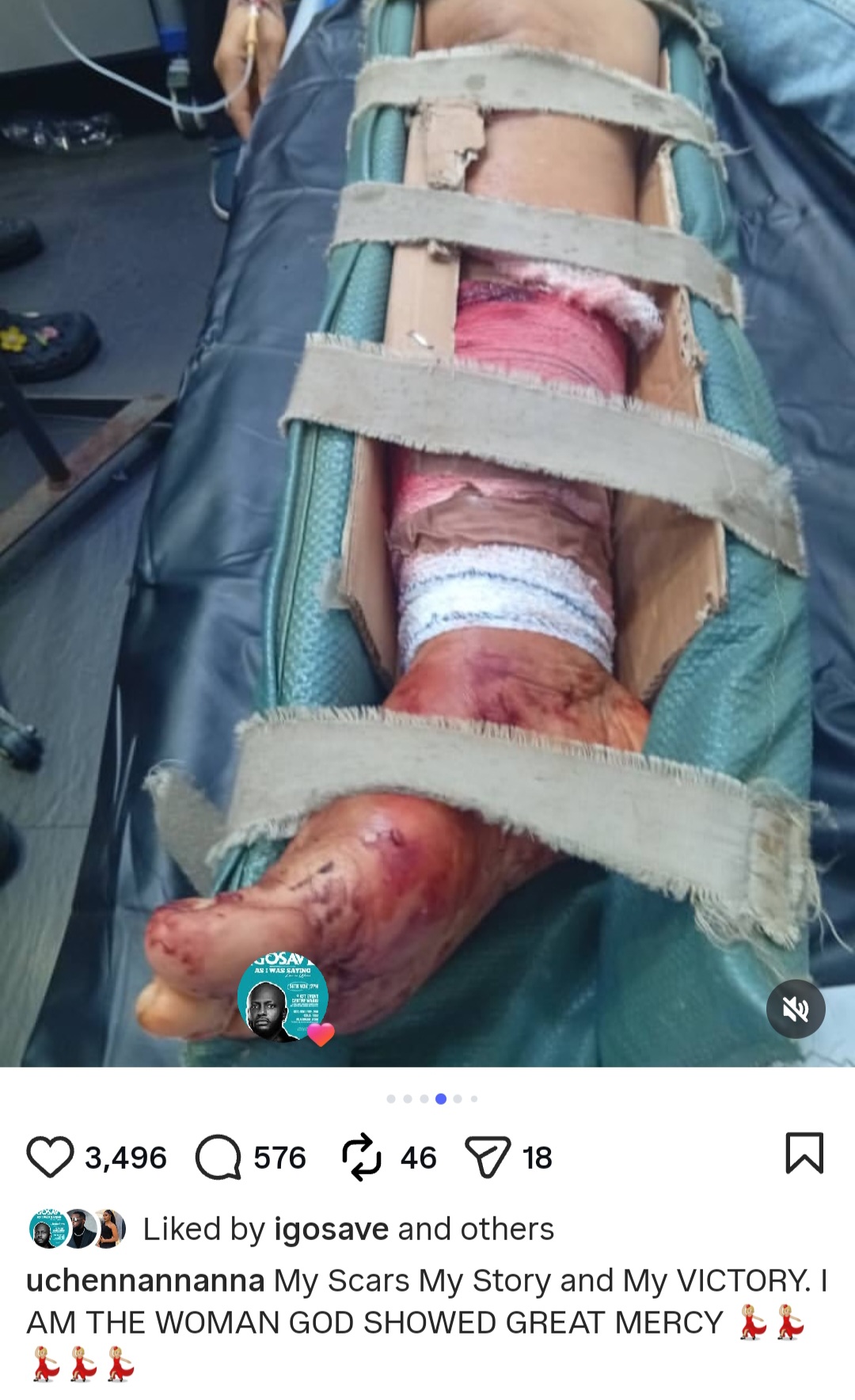Actress Uche Nnanna shows scars as she reveals she survived terrible accident