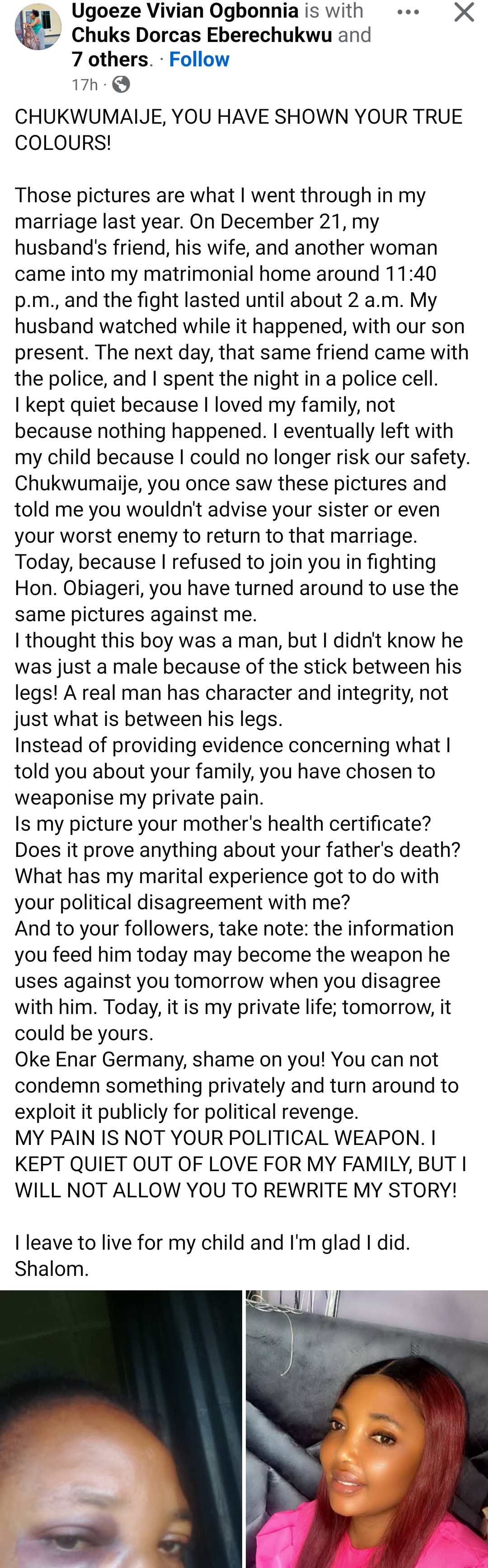"I leave to live for my child" Woman writes as she shares what she allegedly went through in marriage