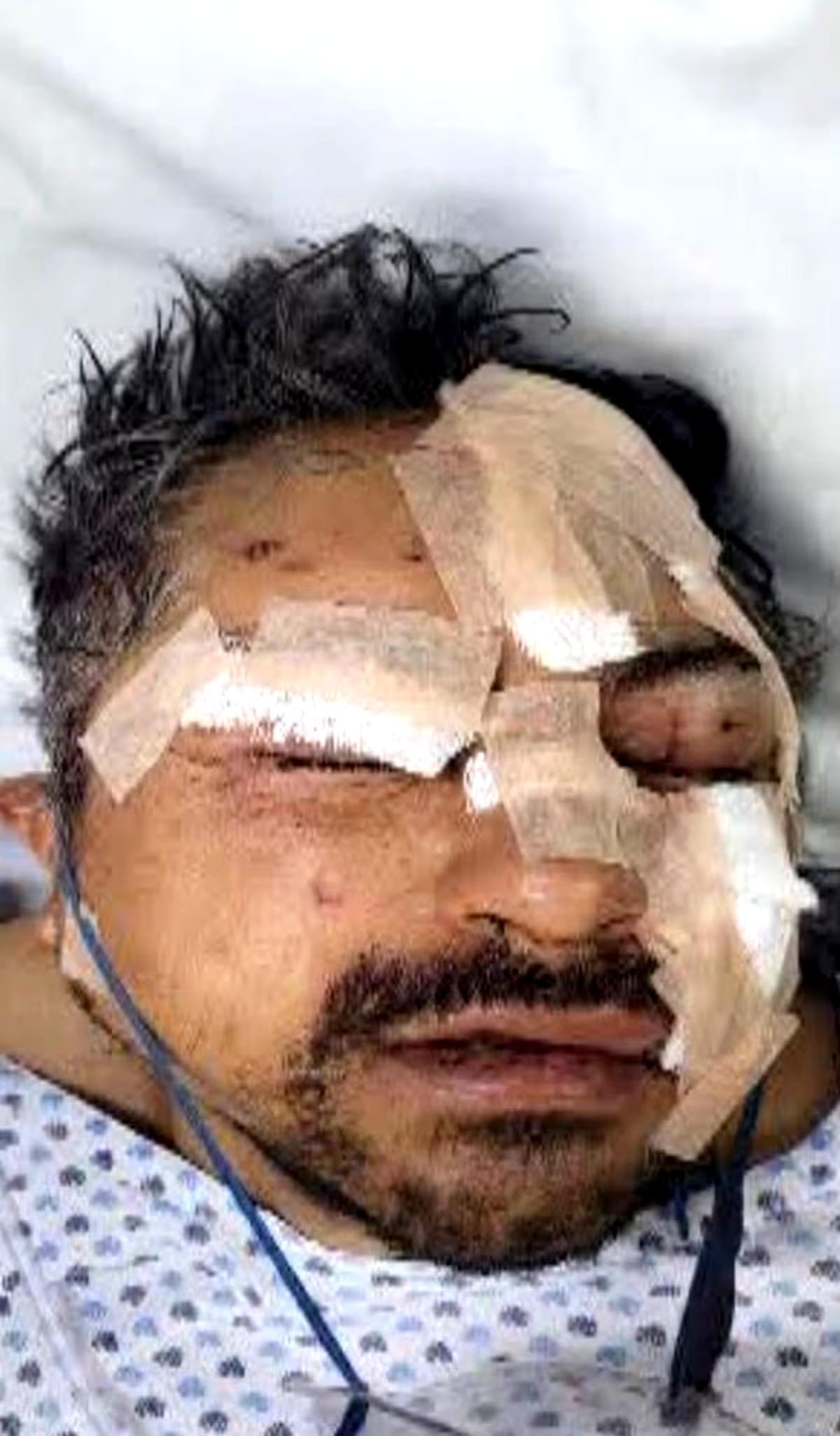 Man mauled by lions and left with horror injuries after releasing them from cages where he sought refuge (video)