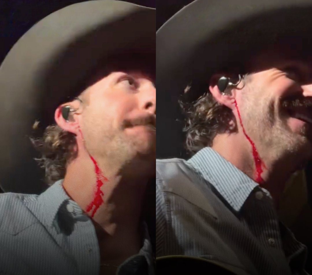 Singer Riley Green bleeds on stage after fan threw phone at his head during concert