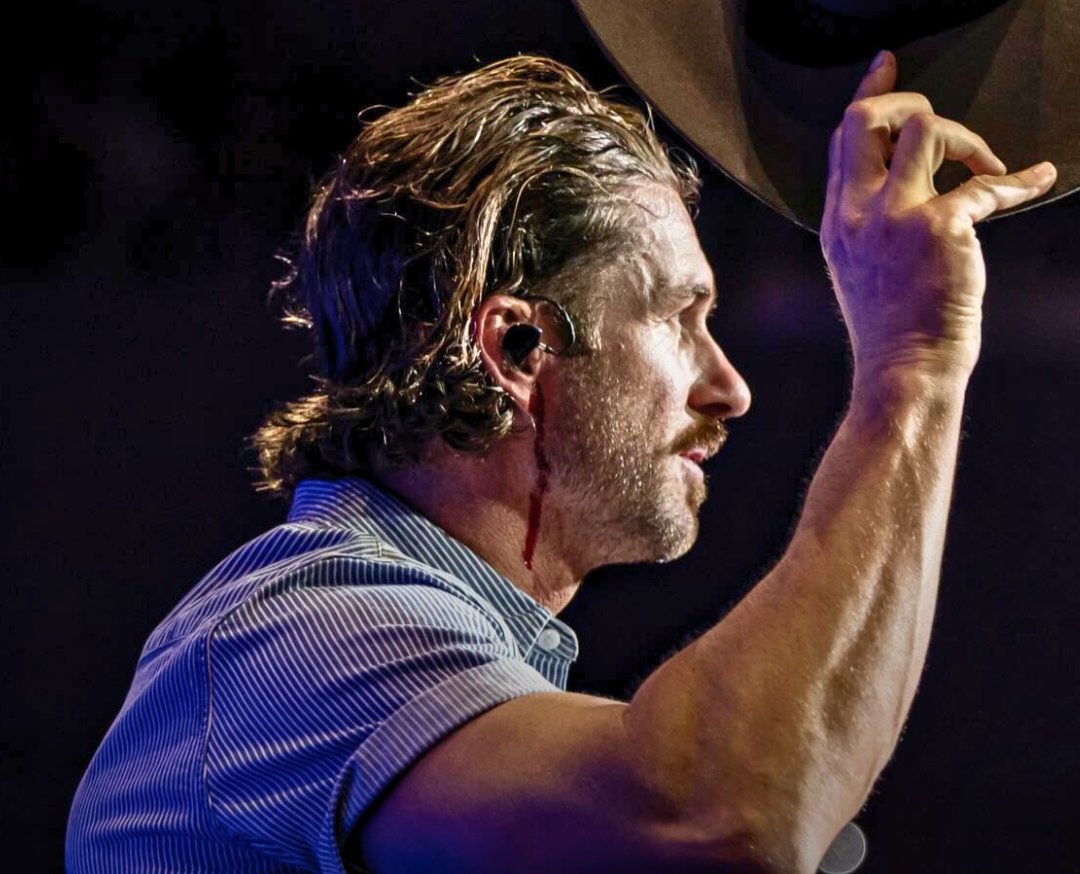 Singer Riley Green bleeds on stage after fan threw phone at his head during concert