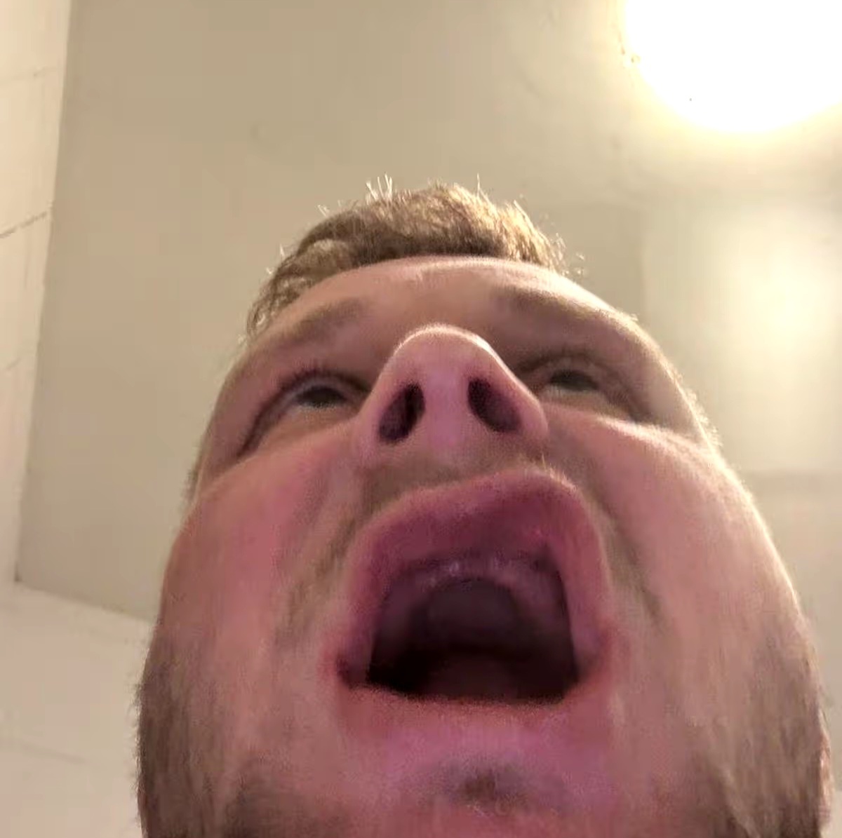 Man who flew to Turkey for teeth surgery left with no teeth at all