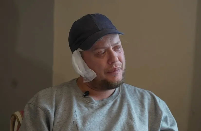 Picture of the dog, Shy, at the center of the fatal mauling incident.