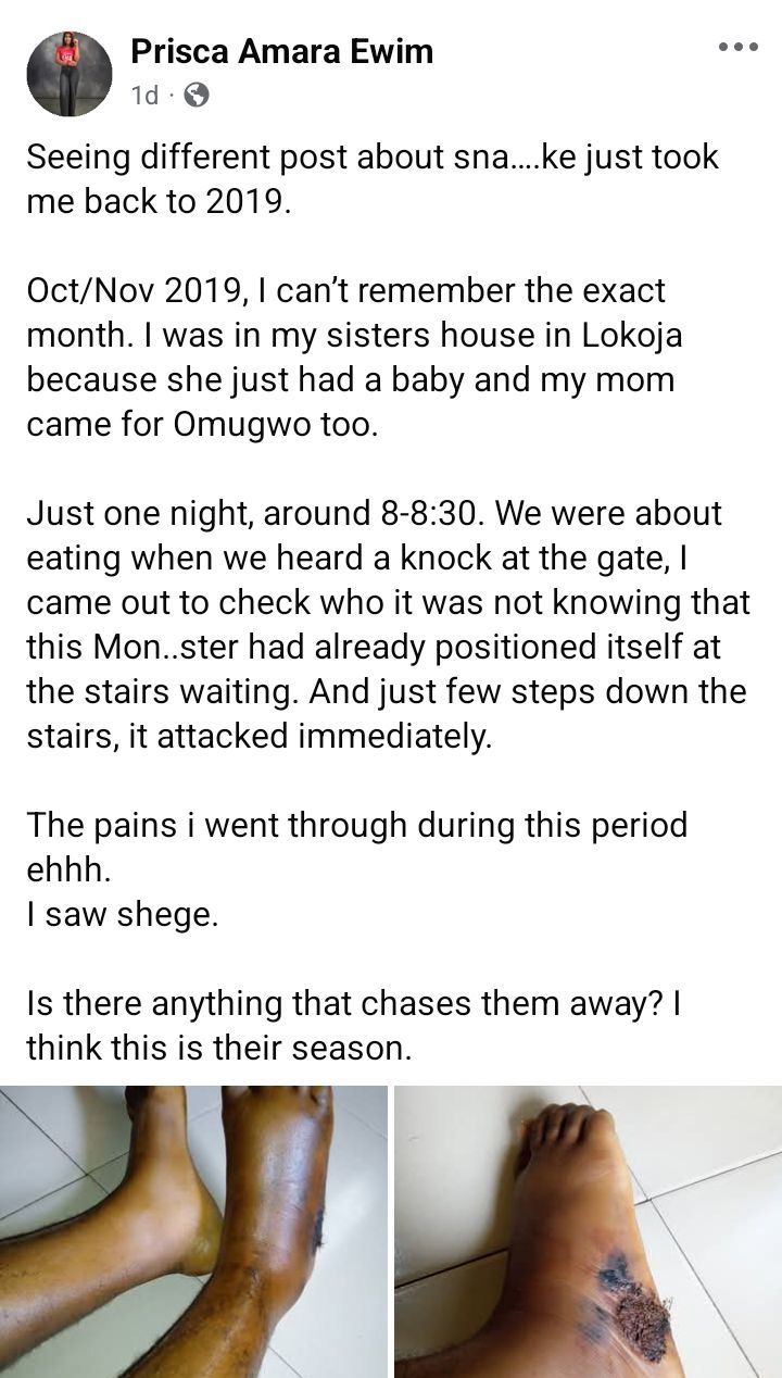 I saw shege - Nigerian lady shares her snake bite story