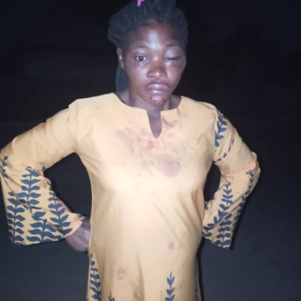 Eight-months pregnant woman allegedly assaulted by her husband in Benue