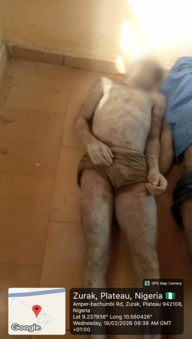 Tragedy in Plateau as suspected gas leak claims 37 lives at mining site