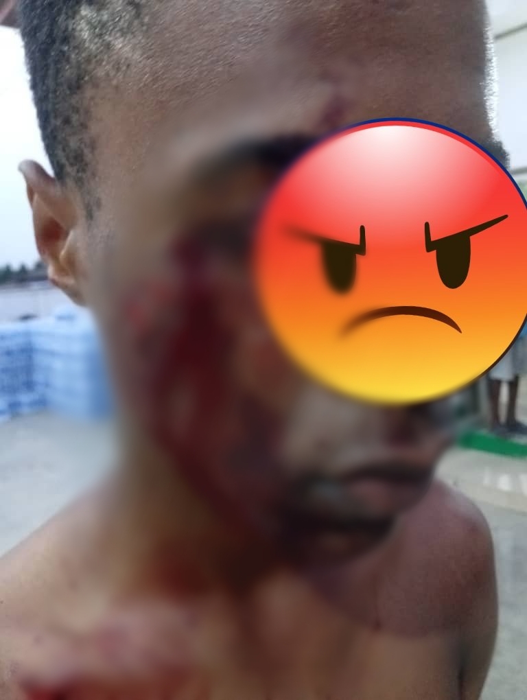 Woman arrested for allegedly st@bbing 16-year-old boy in Lagos