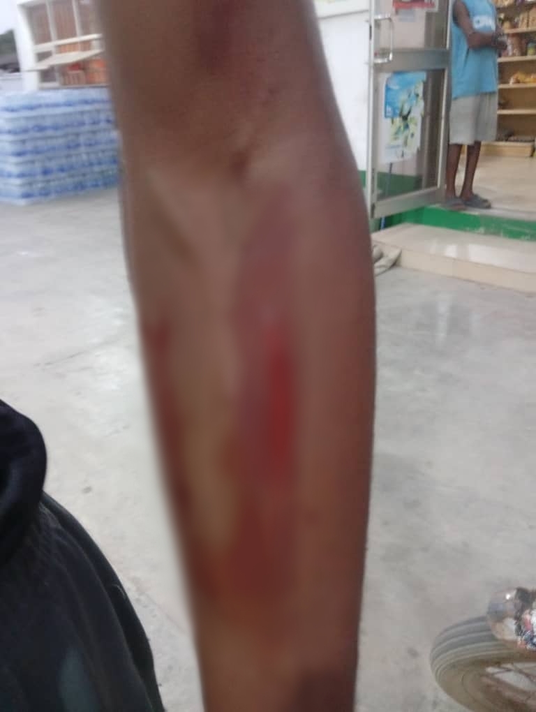 Woman arrested for allegedly st@bbing 16-year-old boy in Lagos