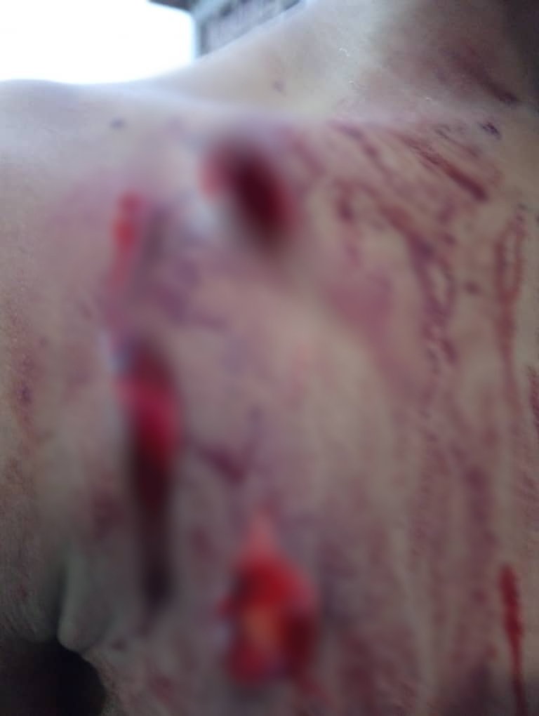 Woman arrested for allegedly st@bbing 16-year-old boy in Lagos