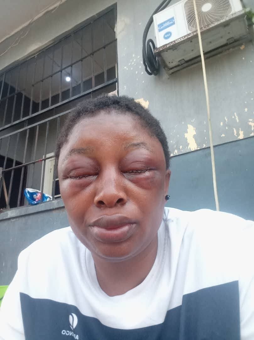 Domestic violence: Cross River Assembly suspends lawmaker for allegedly assaulting his wife