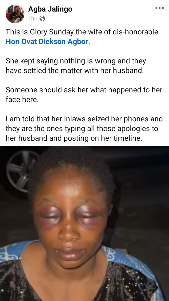 Domestic violence: Cross River Assembly suspends lawmaker for allegedly assaulting his wife