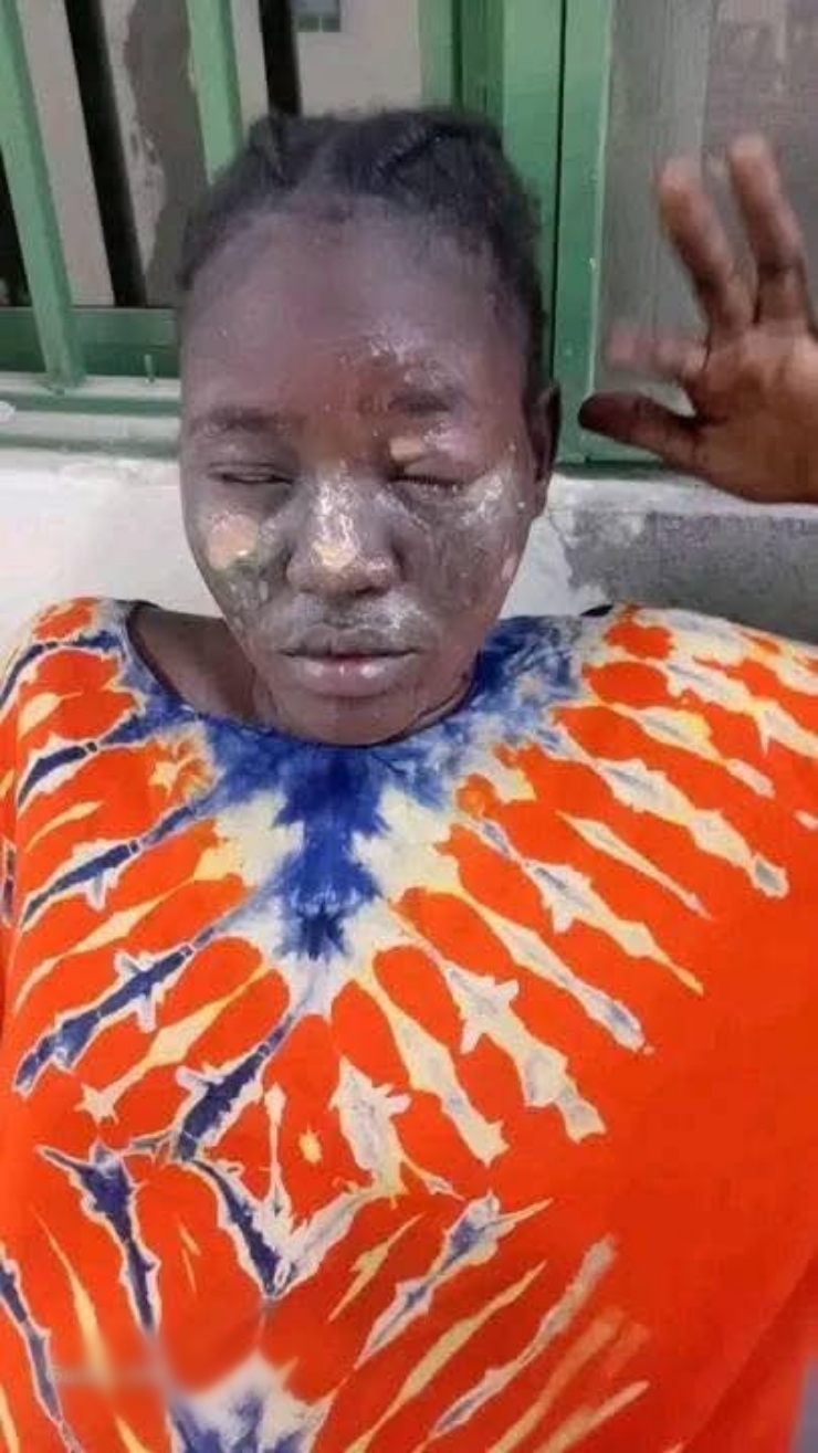 Second wife allegedly pours hot water on first wife during domestic dispute