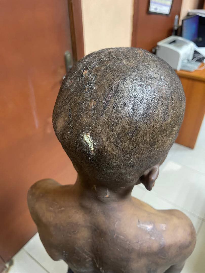Lagos State Govt rescues 11-year-old boy tortured by his biological mother