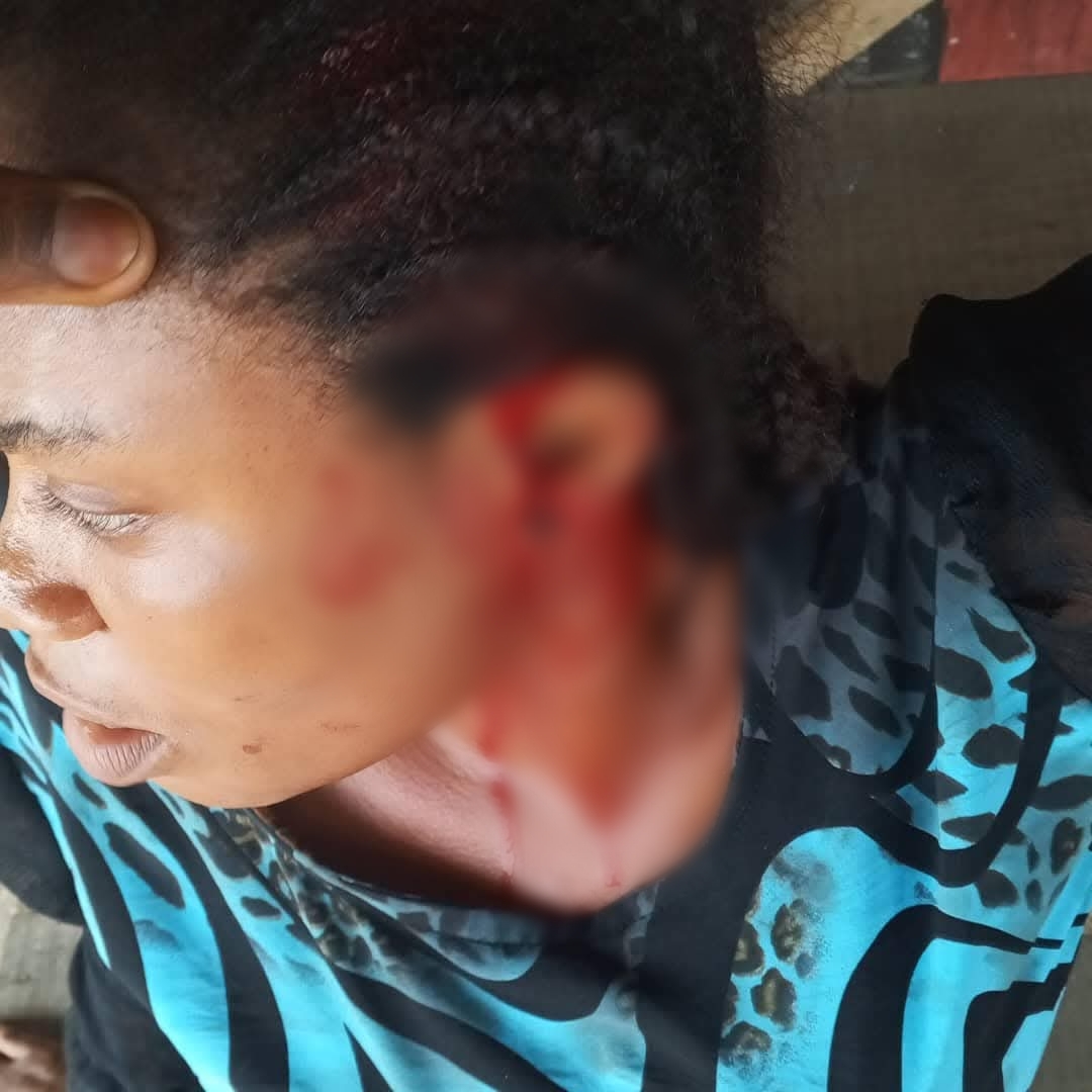 Man ass@ults lady in Akwa Ibom for rejecting his advances (video)