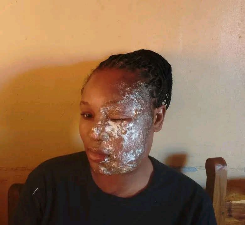 Man arrested for pouring hot cooking oil on his wife