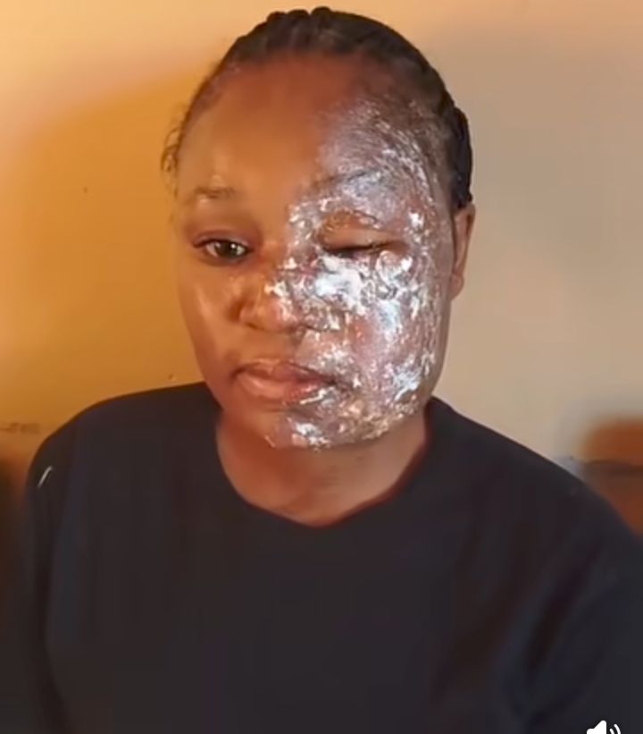 Man arrested for pouring hot cooking oil on his wife