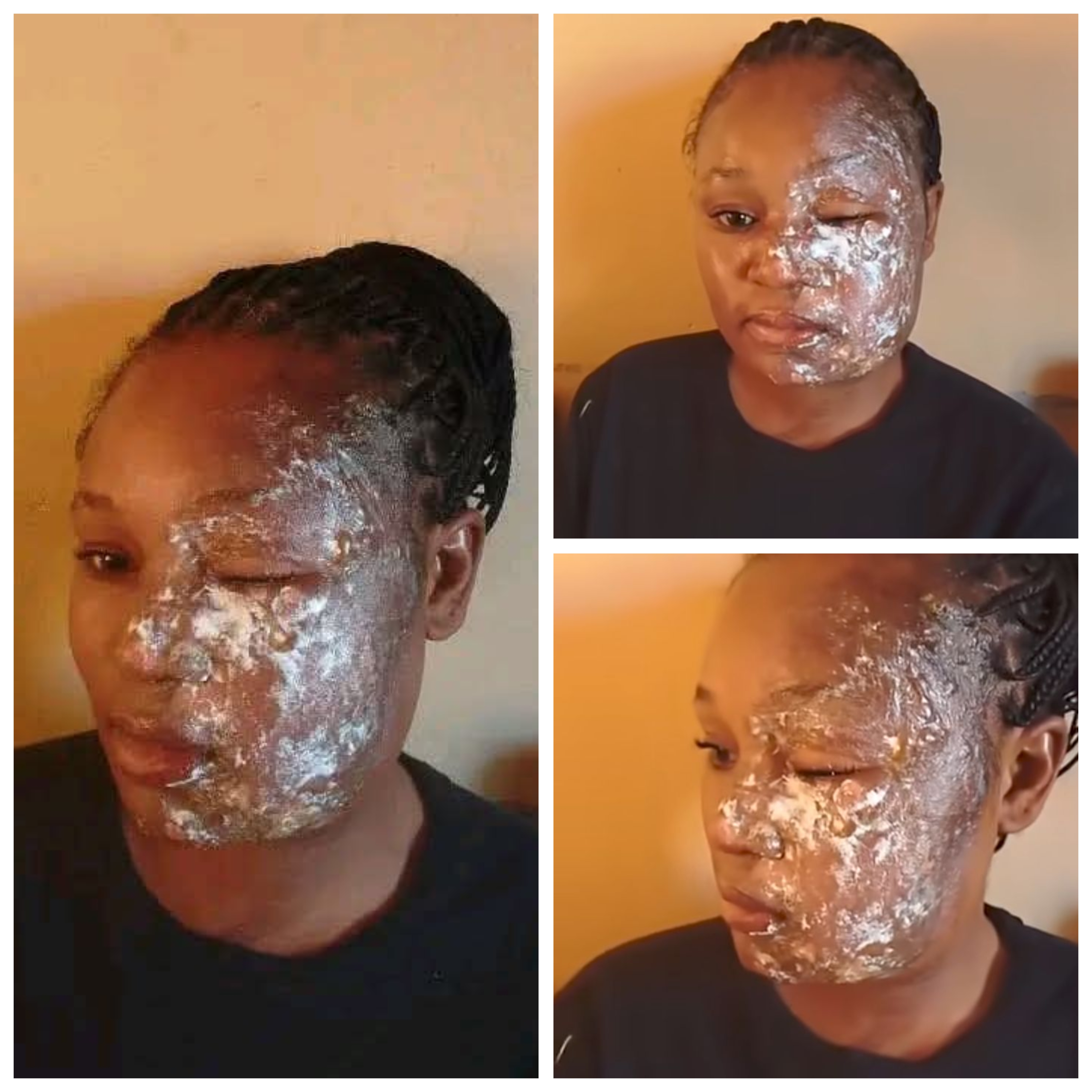 Man arrested for pouring hot cooking oil on his wife