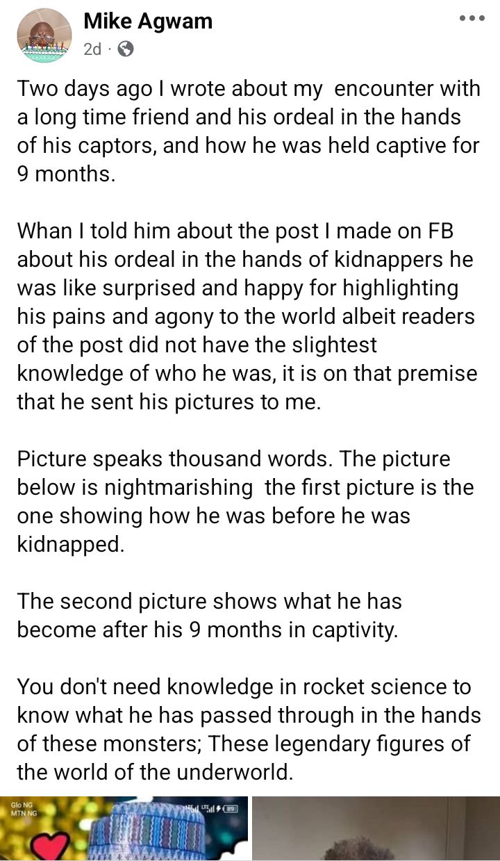 Before and after photos of Nigerian man who regained freedom after 9 months in bandits