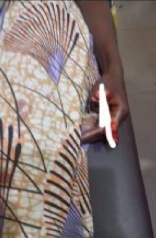 Suspected phone snatchers cut off Bauchi varsity studentâs fingers and ear