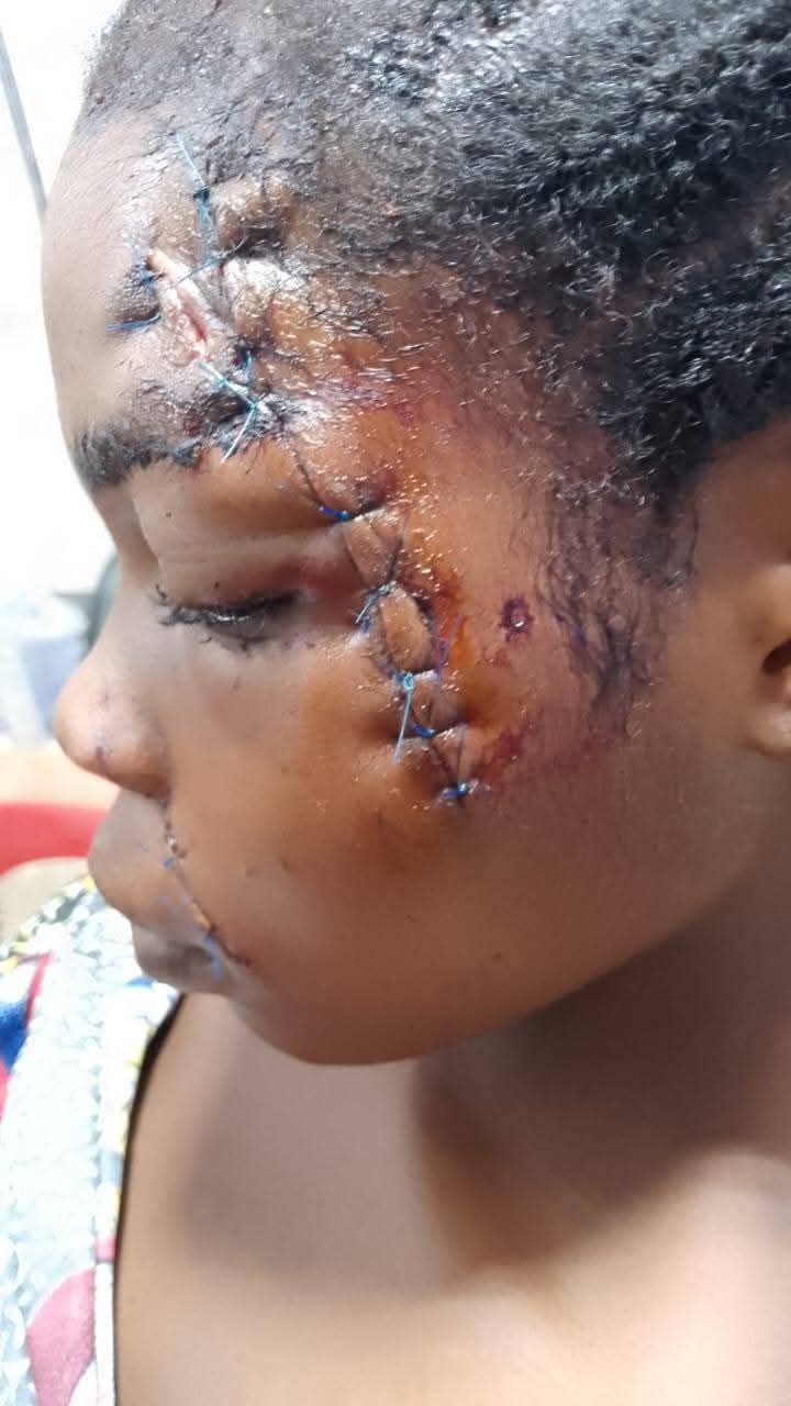 Police officer and six others k!lled, 6 injured in fresh Plateau attack