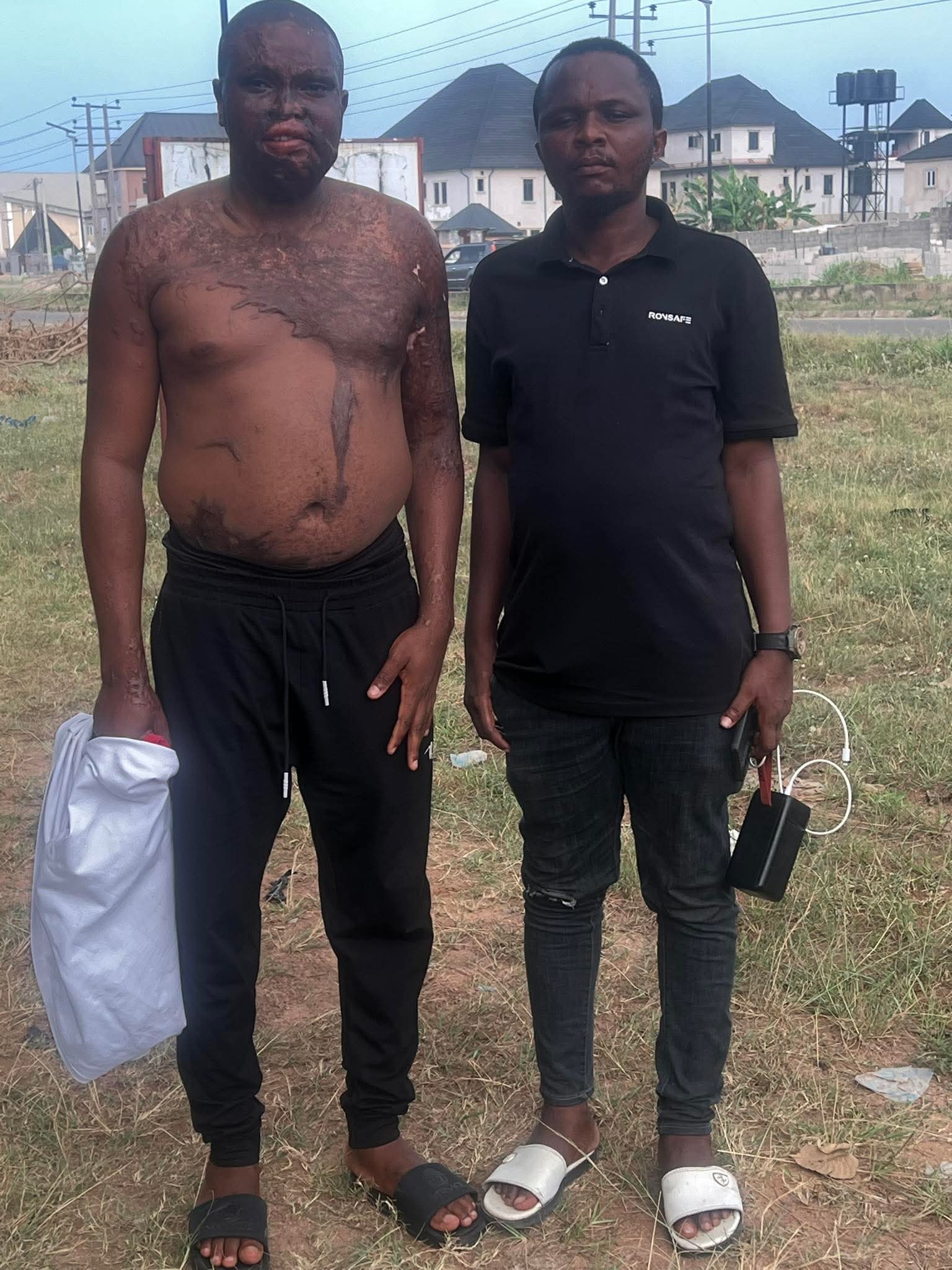 Nigerian man pours acid on his elder brother