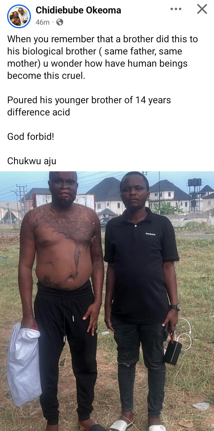 Nigerian man pours acid on his elder brother