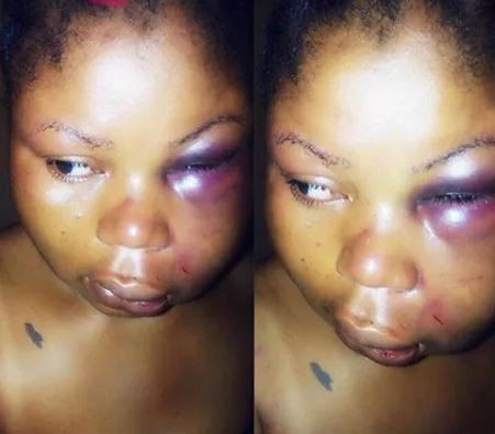 Photo:Lady brutally beaten after entering a one chance bus in Ibadan