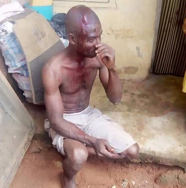 Man stripped naked, beaten to pulp for allegedly raping a 9-year-old girl in Umuahia