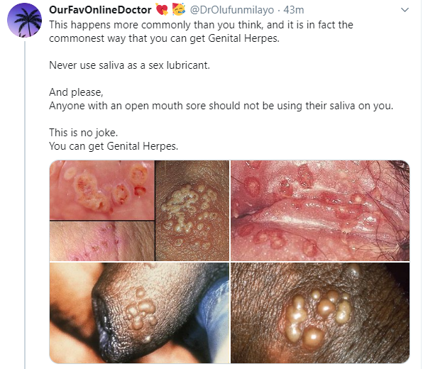 Nigerian doctor warns against the use of saliva as lubricant during sex