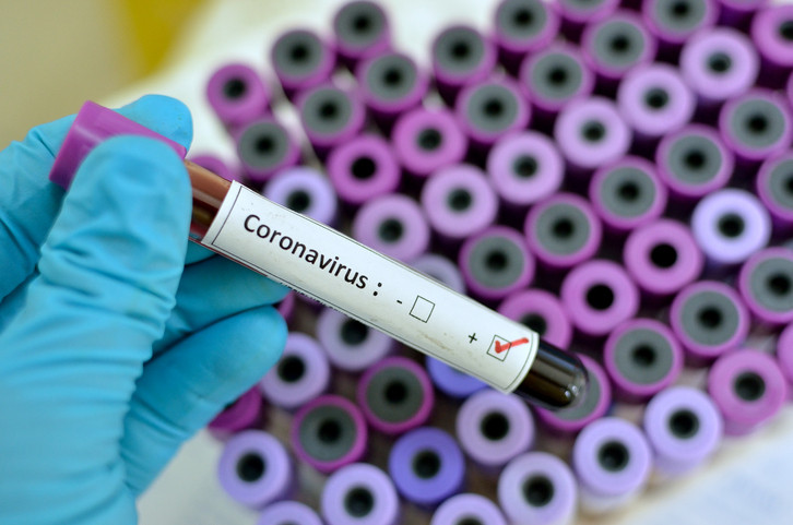 UK returnee who became third case of coronavirus in Nigeria has been living with our staff since Saturday - Bird View Communications President lindaikejisblog 