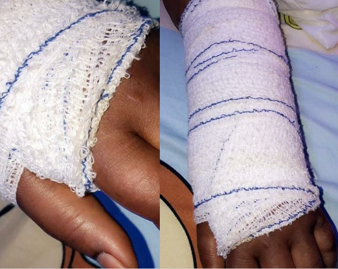 Husband breaks a lady's hand for preventing him from beating his wife...