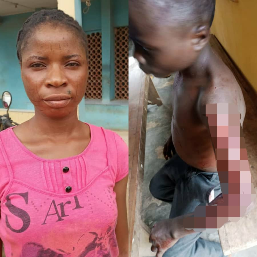 Woman arrested for using razor blade to inflict grievous body injuries on her Neighbor's child over allegations of theft (photos)