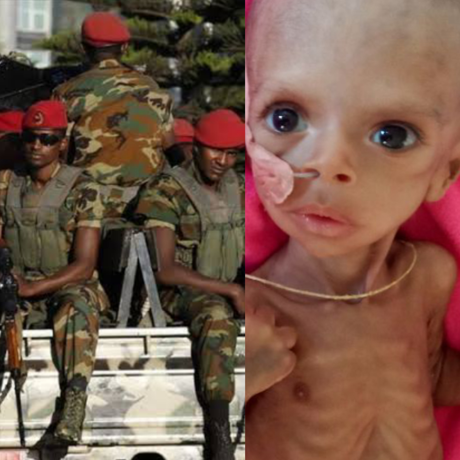 Heartbreaking photos of the malnourished 3 month old baby whose hungry mother can't feed due to war