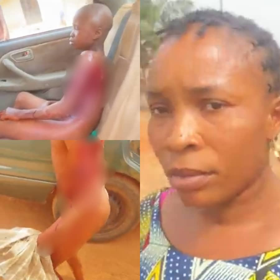 Lady arrested for allegedly brutalizing her underage houseboy and leaving him with bloodied injuries in Ondo (video)