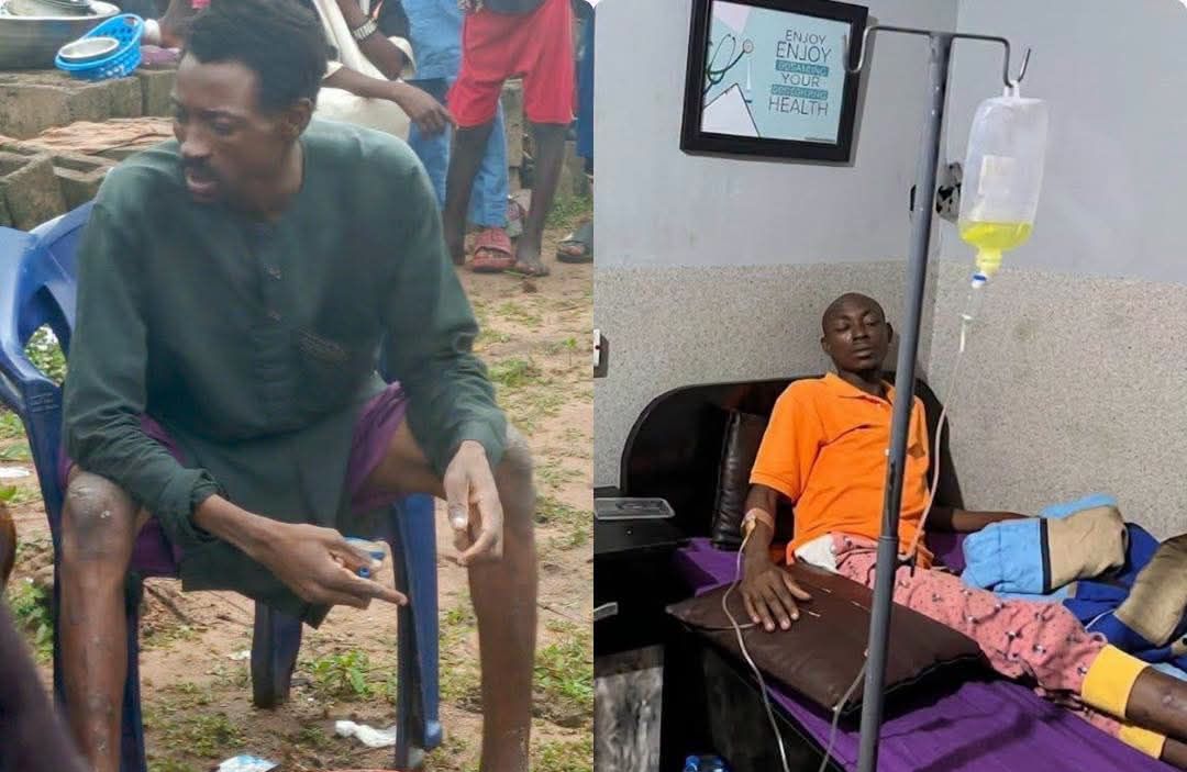 After 141 days in captivity, Kwara man escapes two bandits' camps, walks for nine days