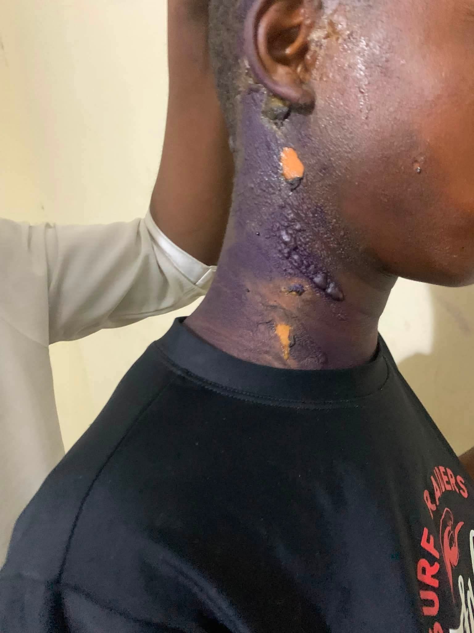 Court sentences woman to six months imprisonment for pouring hot water on her 14-year-old niece in Imo