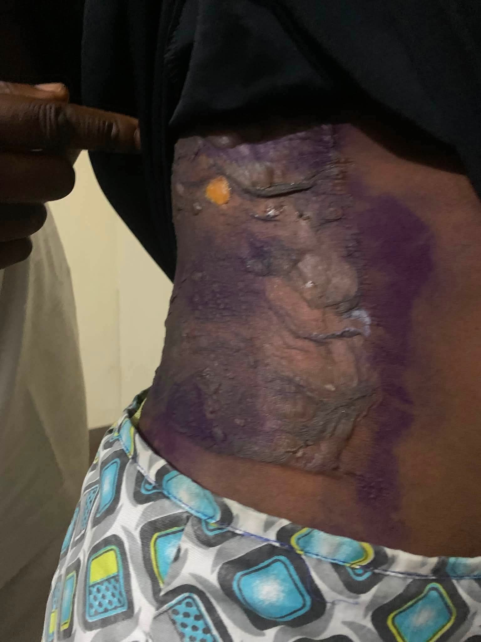 Court sentences woman to six months imprisonment for pouring hot water on her 14-year-old niece in Imo