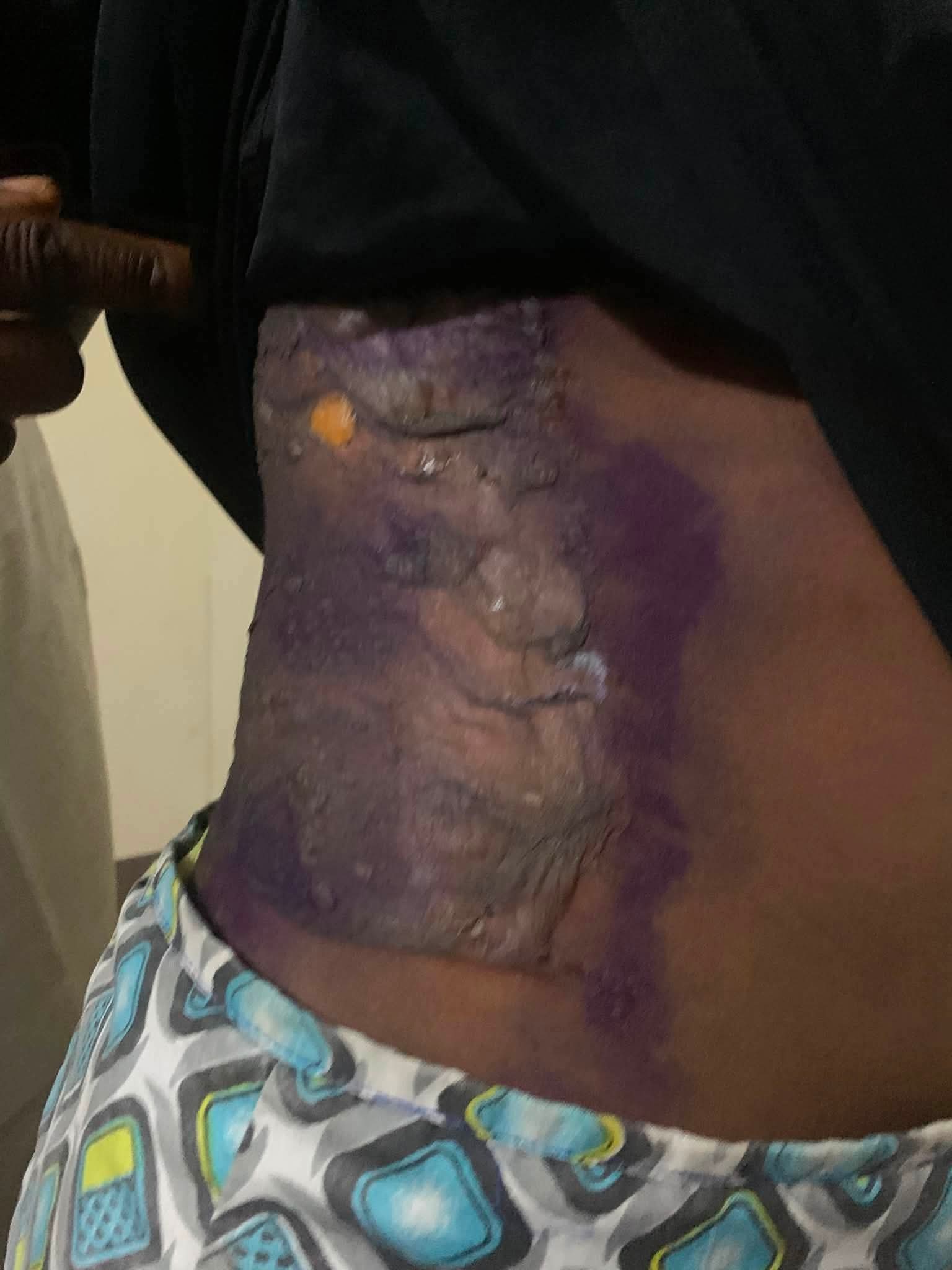 Court sentences woman to six months imprisonment for pouring hot water on her 14-year-old niece in Imo