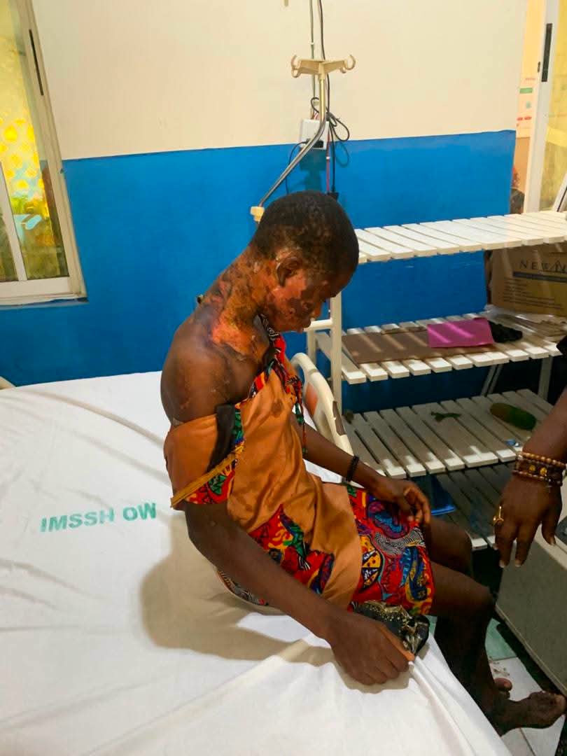 Court sentences woman to six months imprisonment for pouring hot water on her 14-year-old niece in Imo