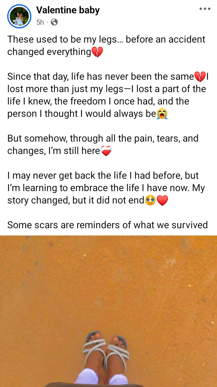 I wish I stayed home that day - Nigerian woman who lost both legs in accident shares her regrets
