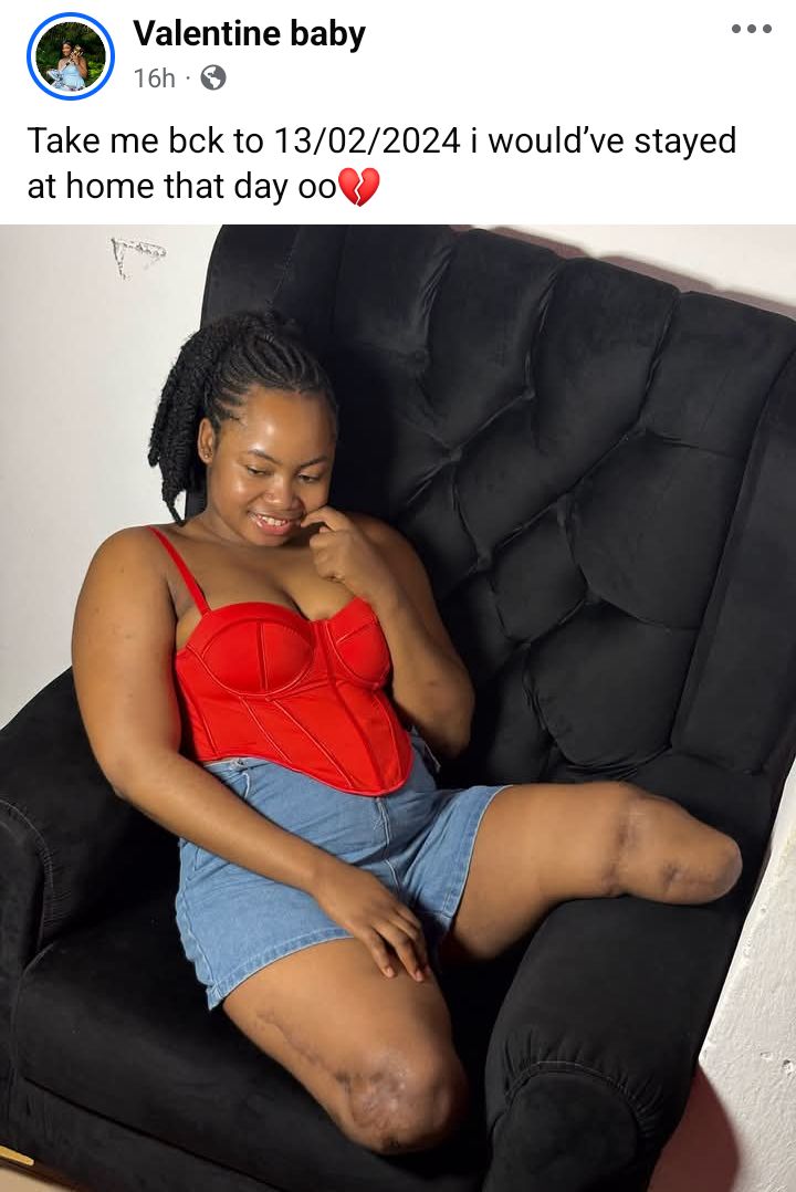 I wish I stayed home that day - Nigerian woman who lost both legs in accident shares her regrets