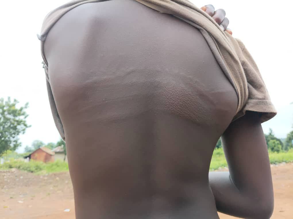 Outrage as Nasarawa school principal allegedly beats JSS 2 student for failing to do manual labour