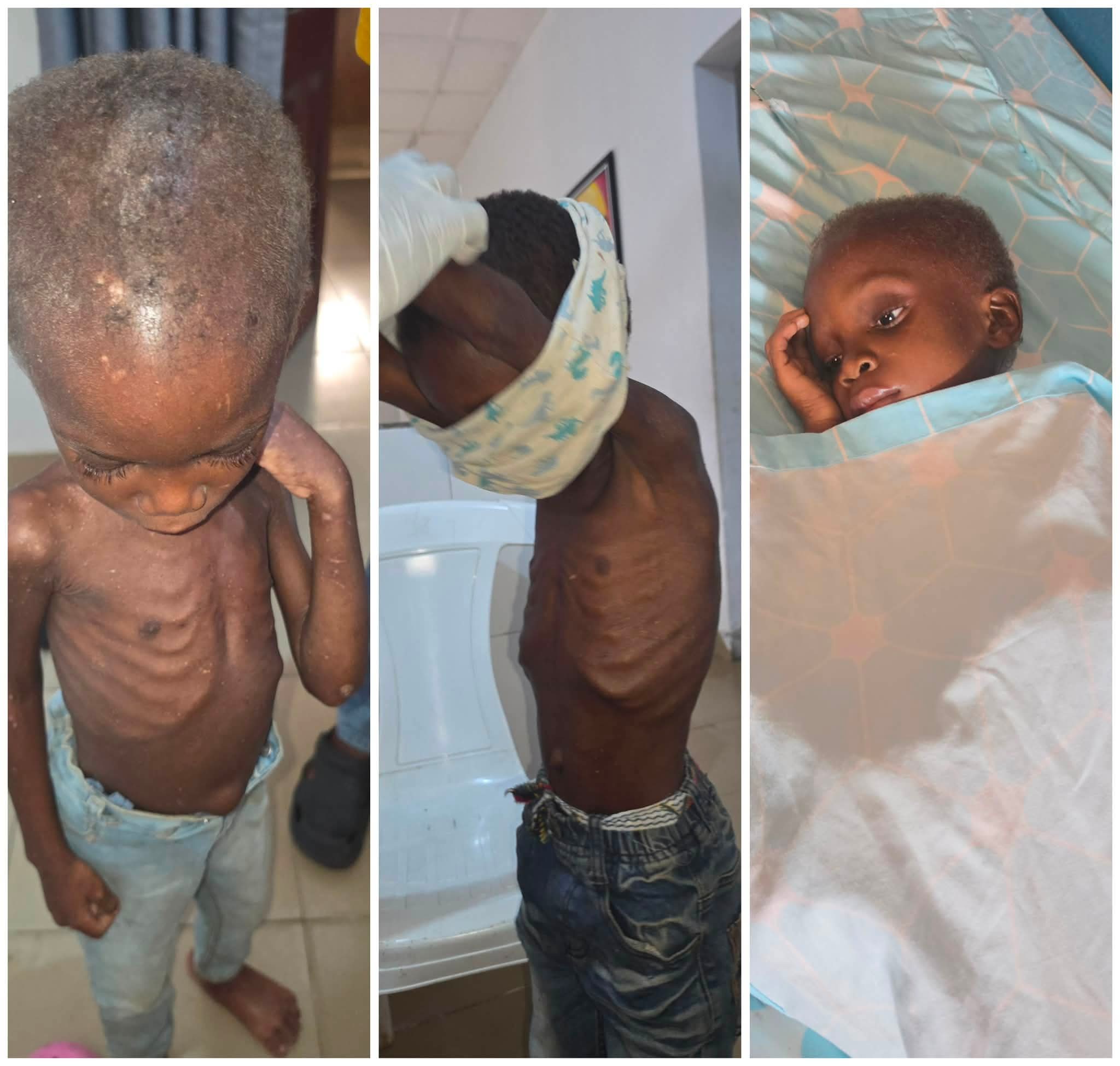 Video showing transformation of 3 children rescued after being branded witches and starved in Akwa Ibom