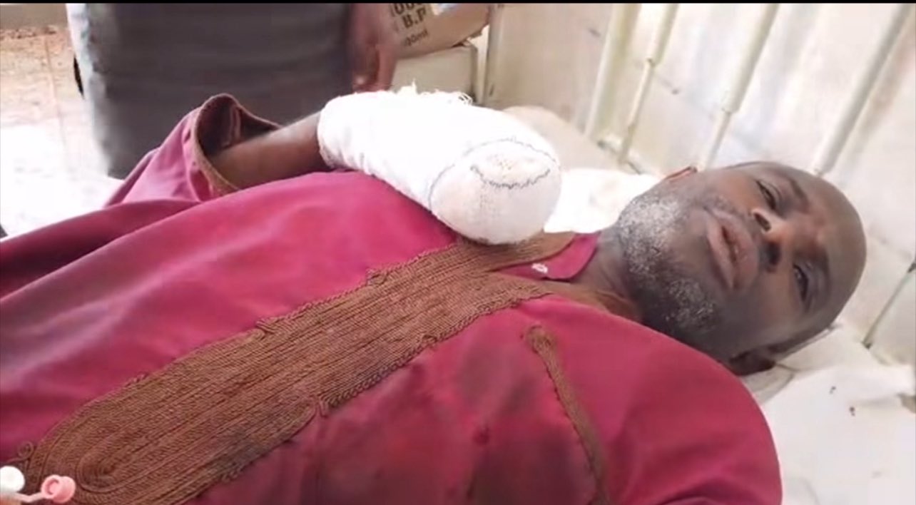 Fulani man succumbs to injuries after suspected militia attack in Plateau
