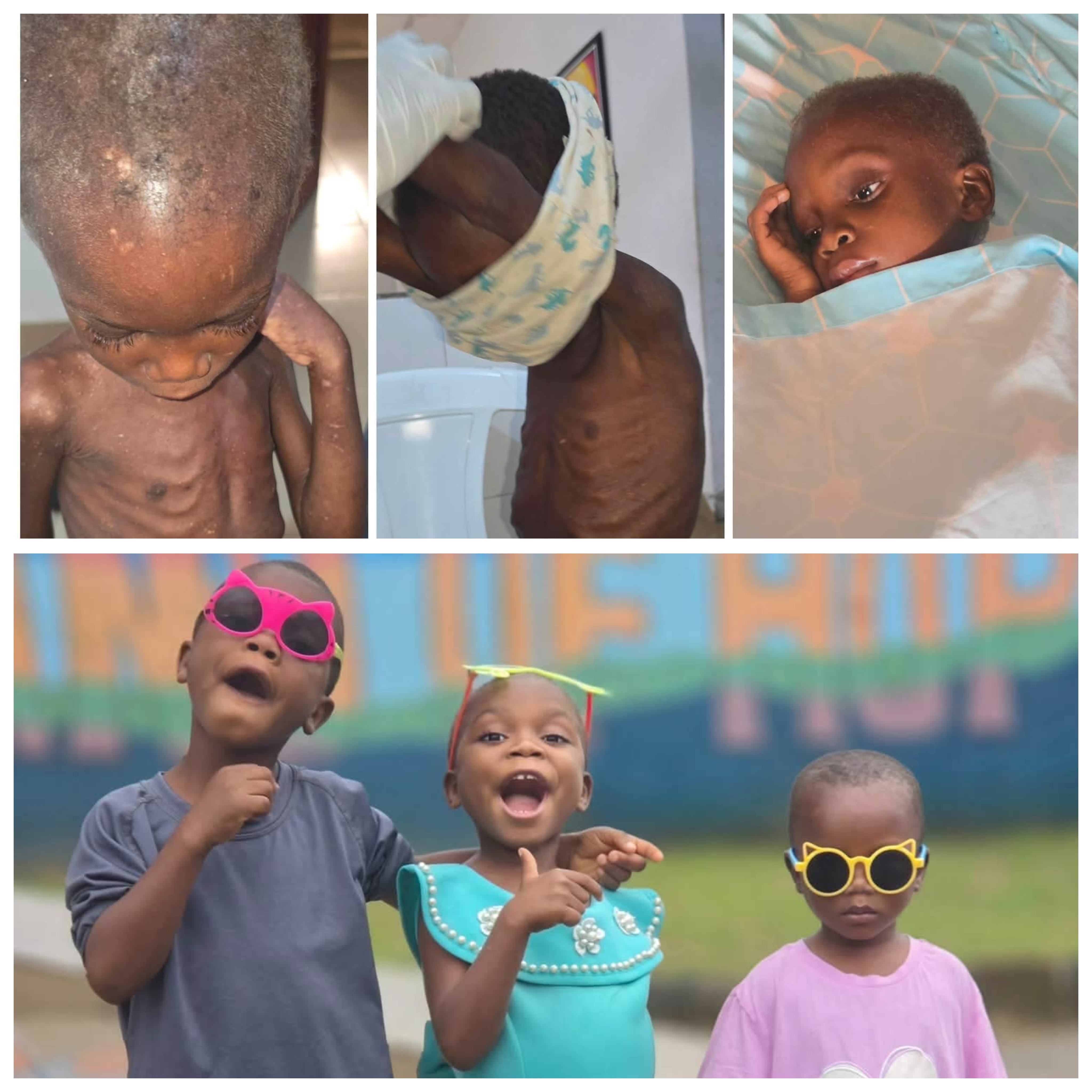 Video showing transformation of 3 children rescued after being branded witches and starved in Akwa Ibom